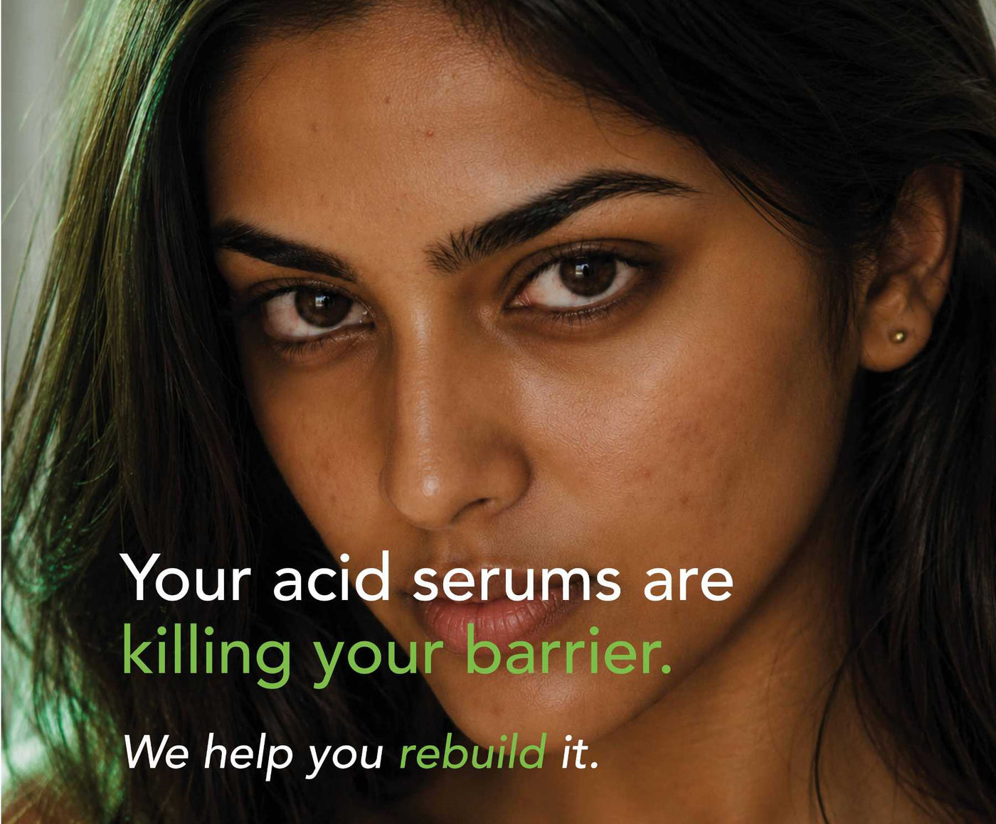 Acne, Blemish Control Serum - image 2