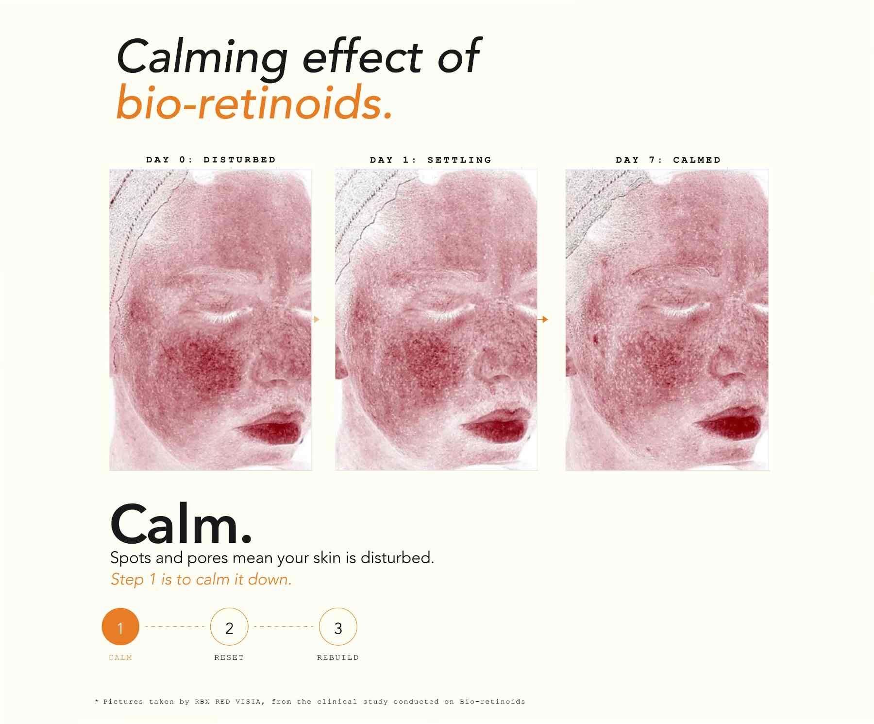 Three-panel comparison of a face over several days showing skin tone settling and calming