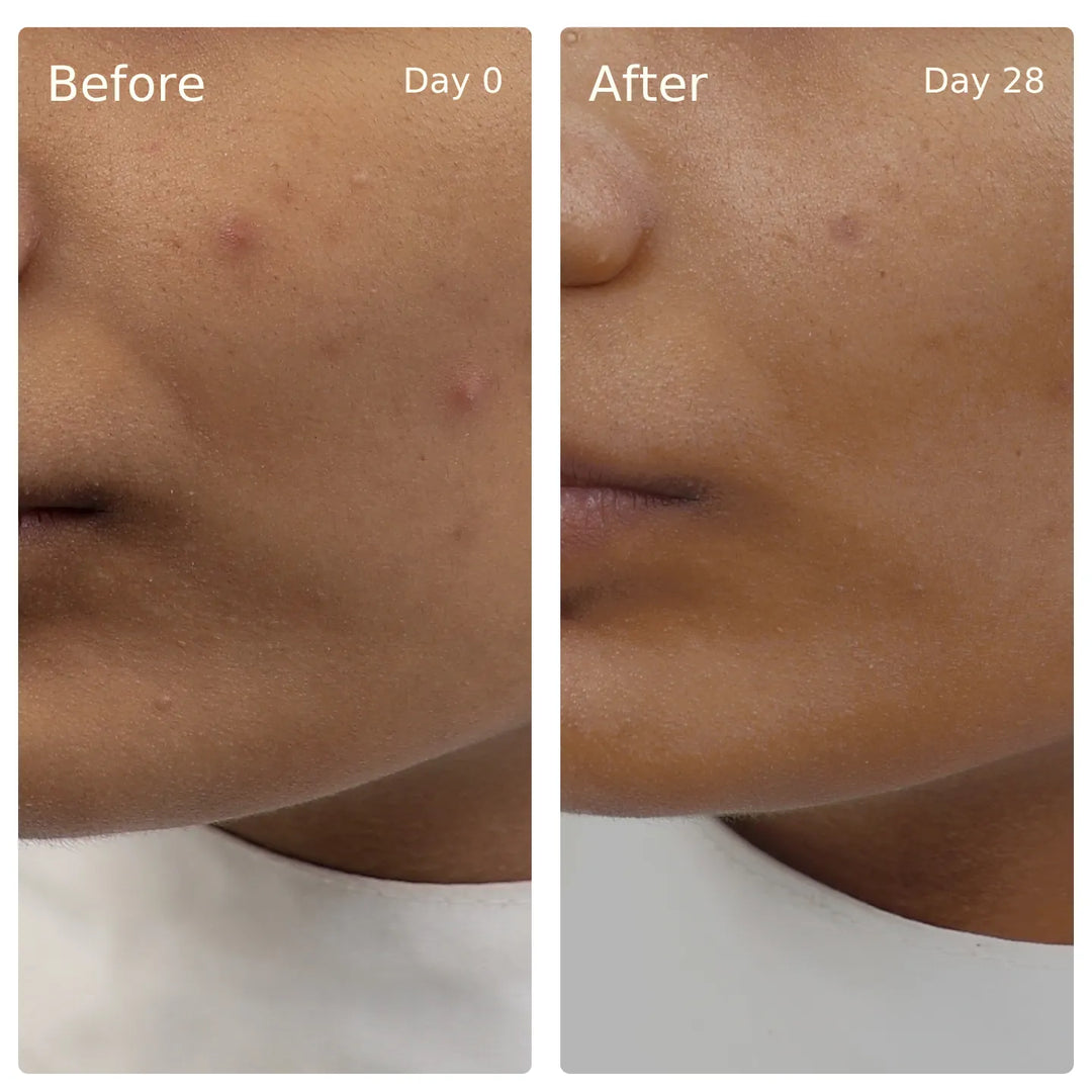 Clinical trial before and after, Deep Hydration, Glow Serum
