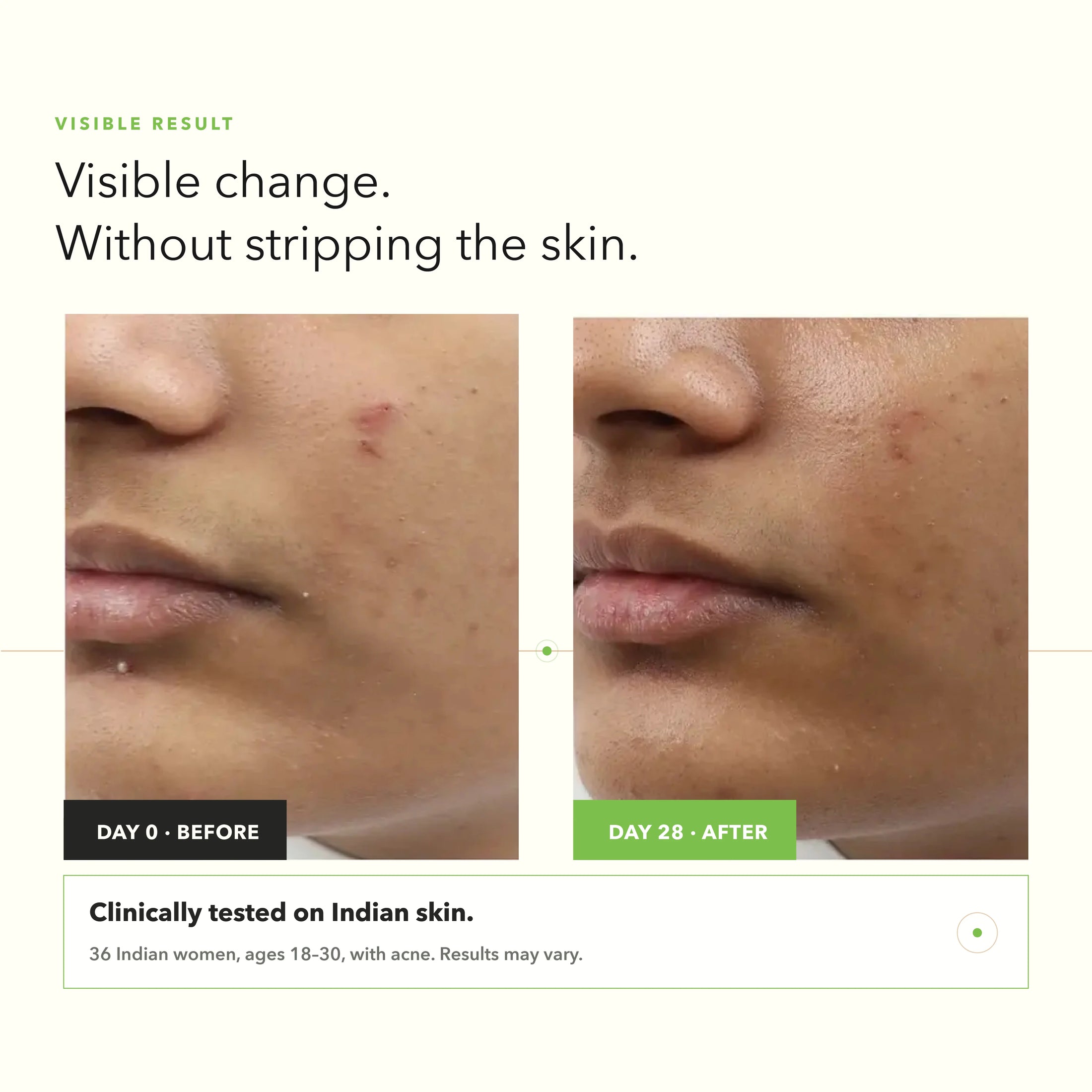Acne, Blemish Control Serum
