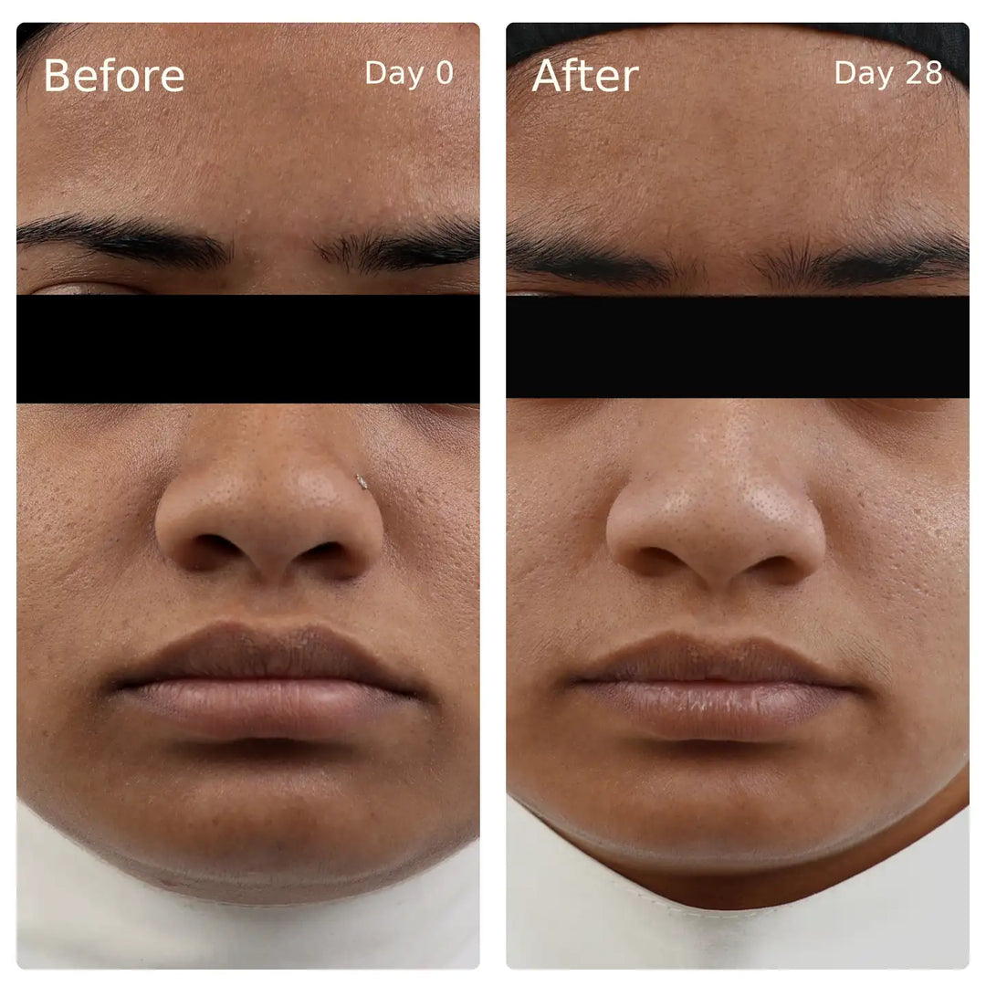 Clinical trial before and after, Deep Hydration, Glow Serum
