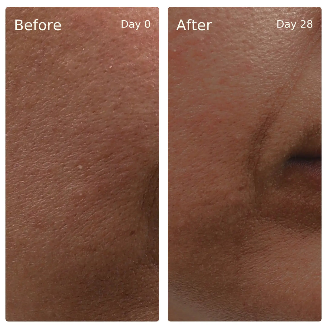 Clinical trial before and after, Deep Hydration, Glow Serum