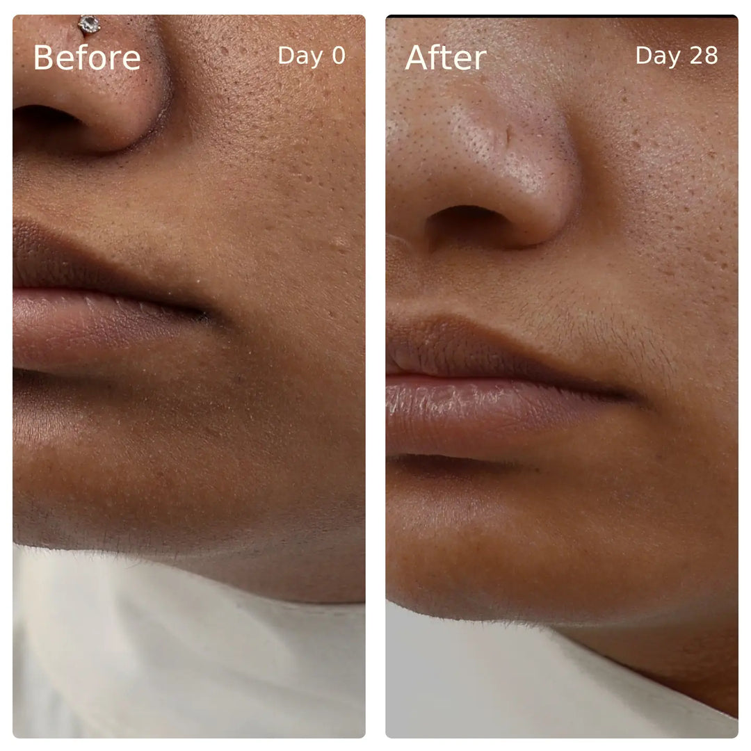 Clinical trial before and after, Deep Hydration, Glow Serum