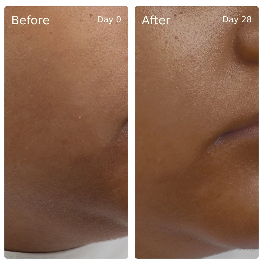Clinical trial before and after, Deep Hydration, Glow Serum