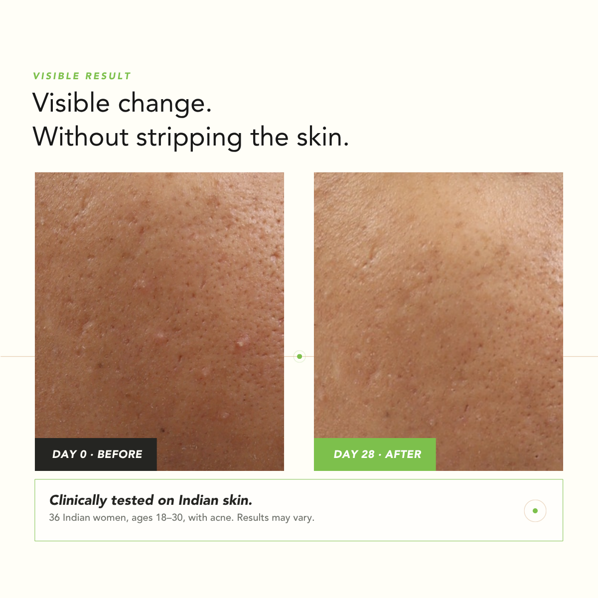 Acne, Blemish Control Serum - image 7
