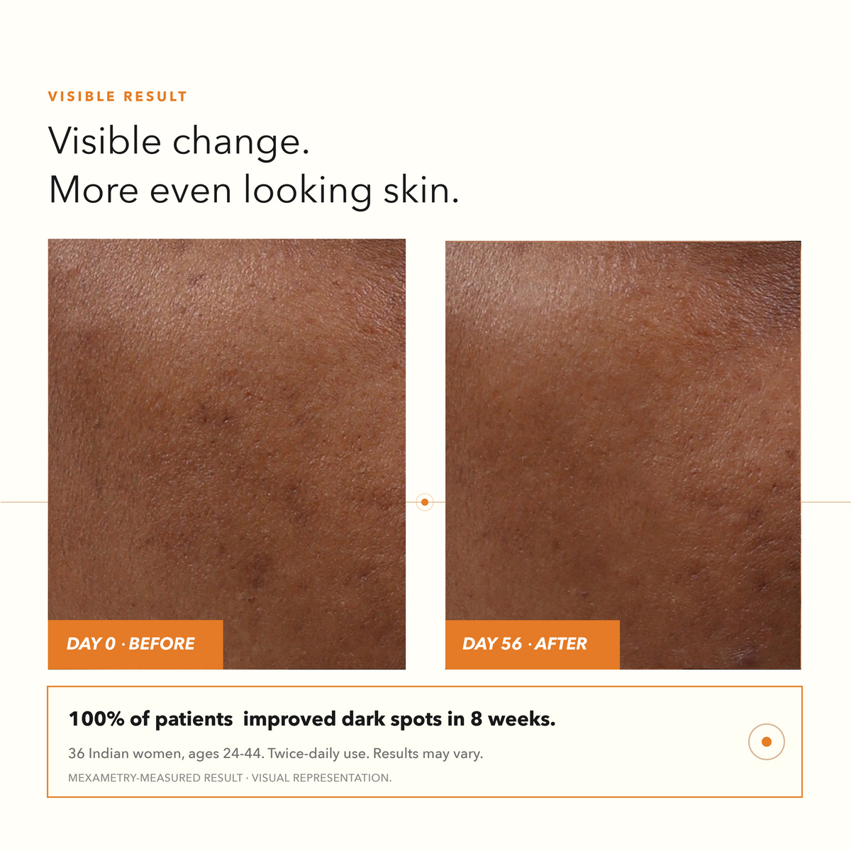 Dark Spots, Pore Control Serum