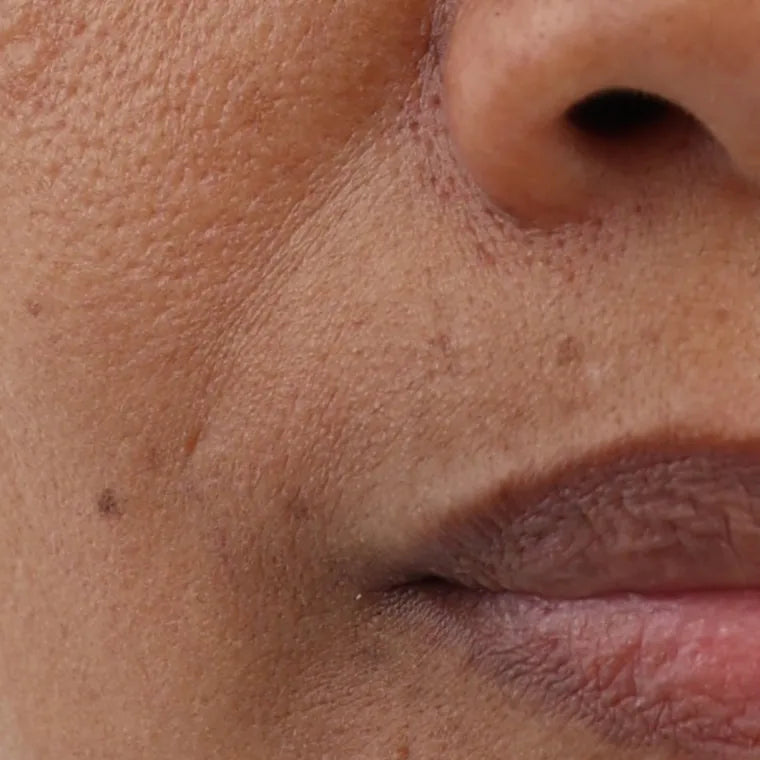 Pores look smaller