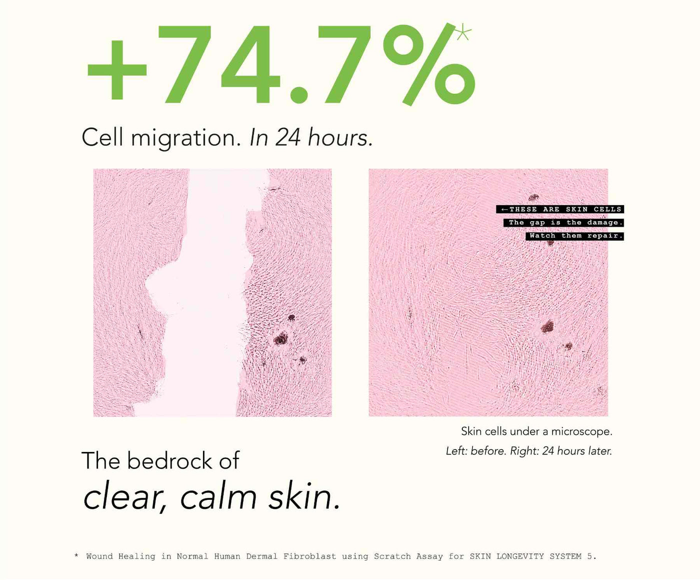 Acne, Blemish Control Serum - image 5
